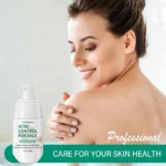 Acne Control Face Cream Spu760487949359 2