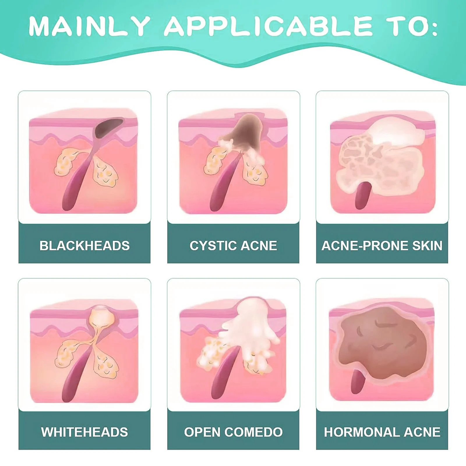 YURHERSU Acne Control Cream for Face - Minimizes Pores, Hydrates & Prevents Breakouts 6 acne control face cream spu760487949359 desc 6