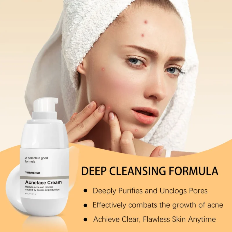 Acne Cream Treatment Spu863616191893 4