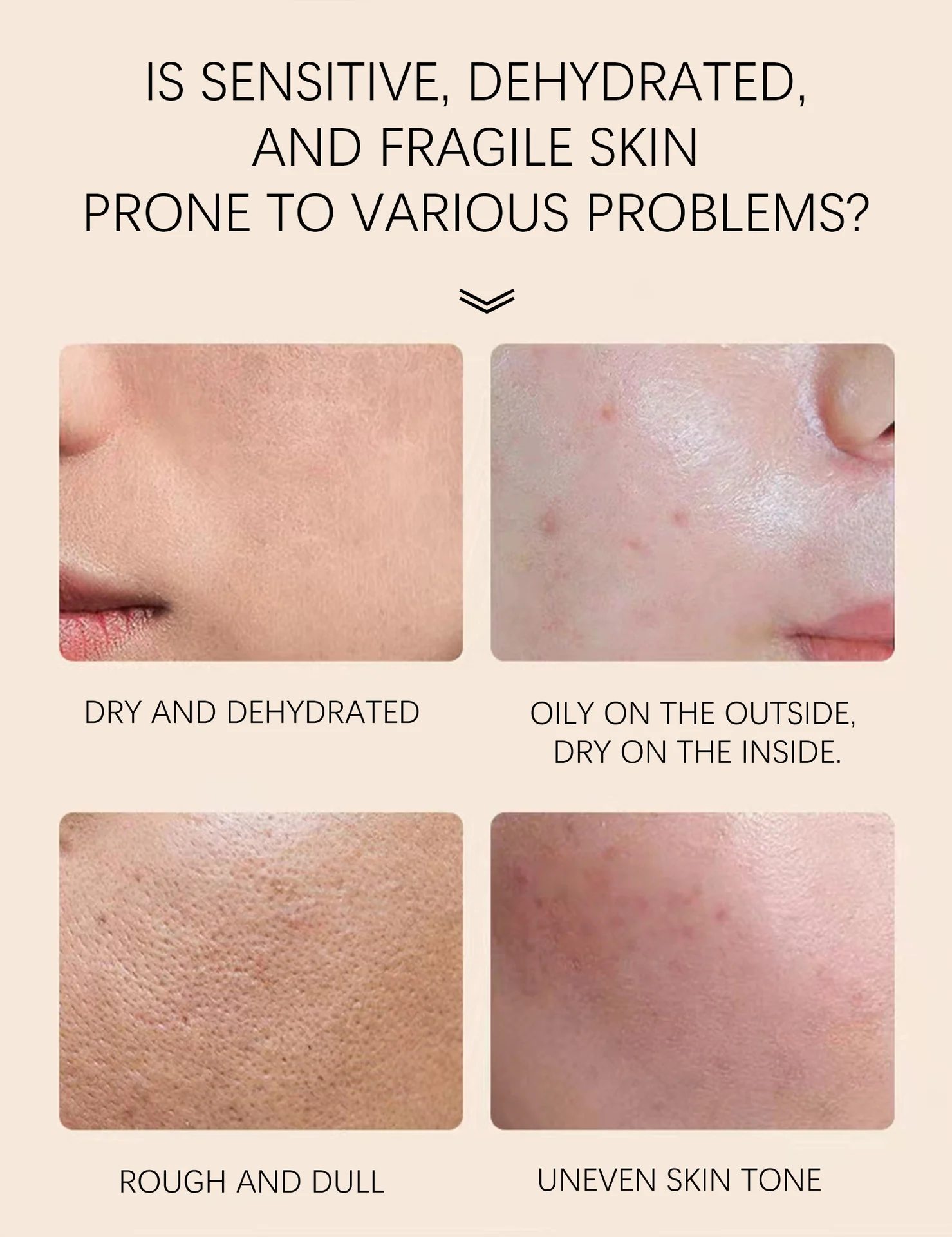 acne cream treatment spu863616191893 desc 4