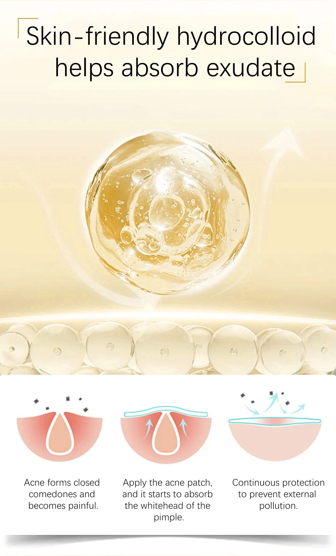 acne patches spu919760083313 desc 4