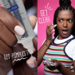 Acne Spot Treatment Cream Spu722274323773 2