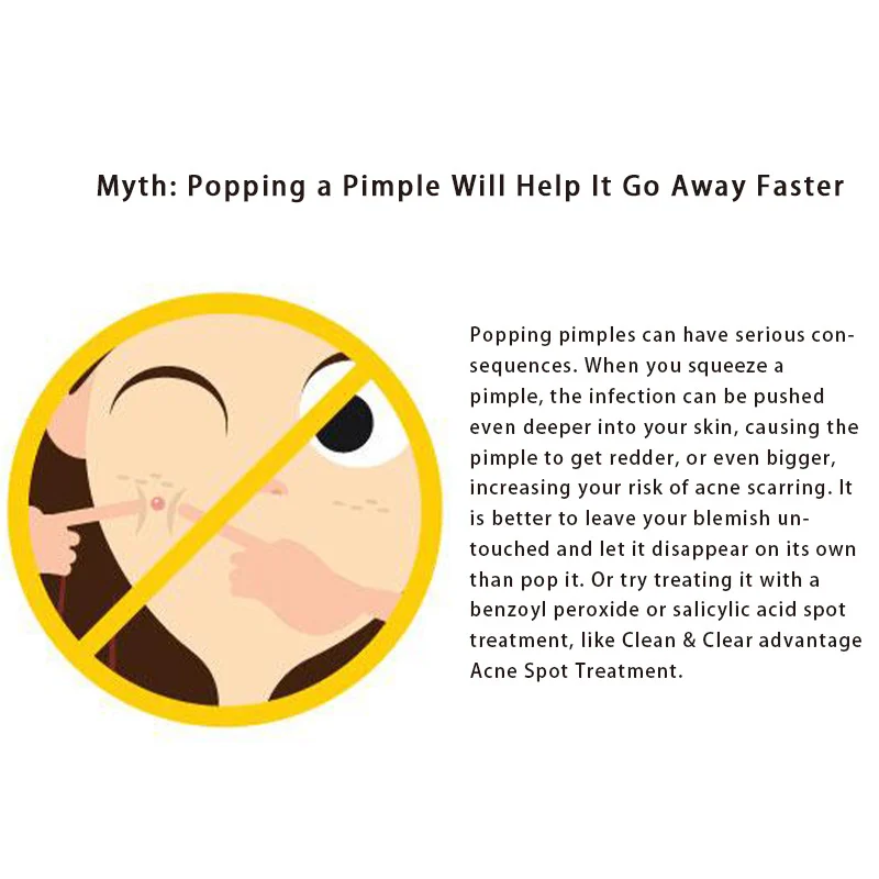 acne spot treatment cream spu722274323773 desc 8