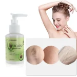 Avocado Hair Removal Cream Spu952618970105 3