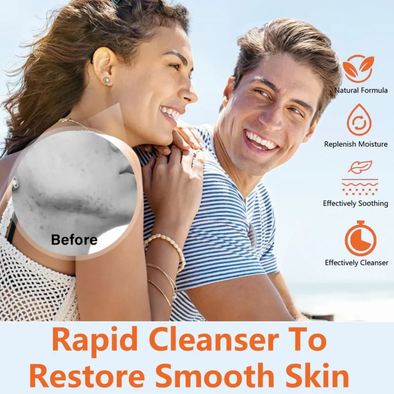 Azelaic Acid Acne Treatment Cream Spu789839093665 4