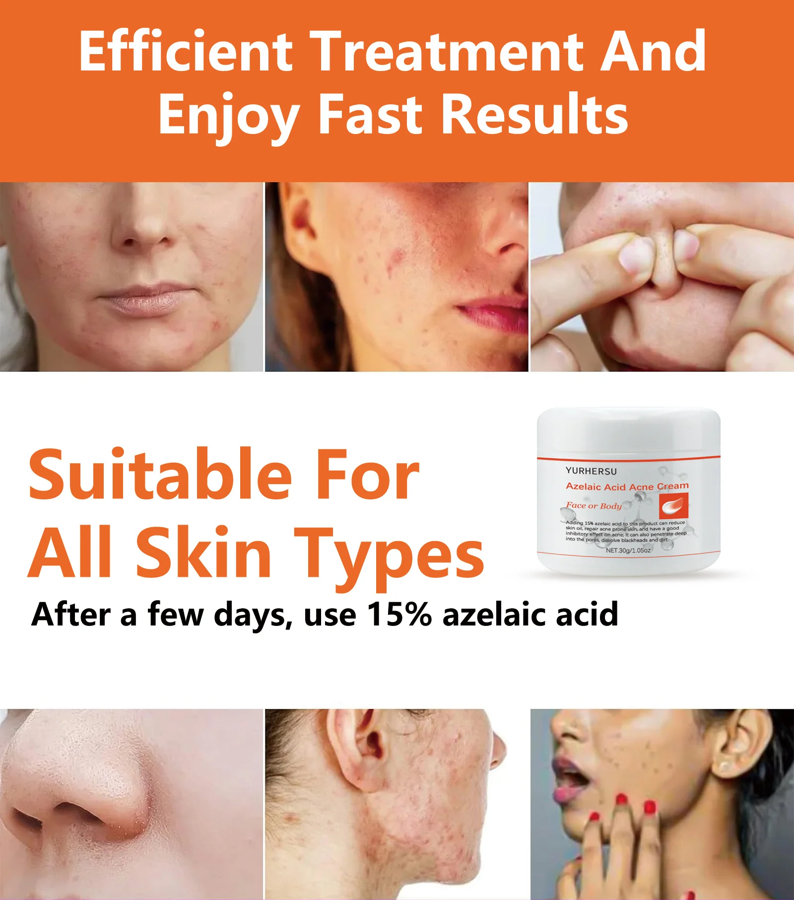azelaic acid acne treatment cream spu789839093665 desc 5