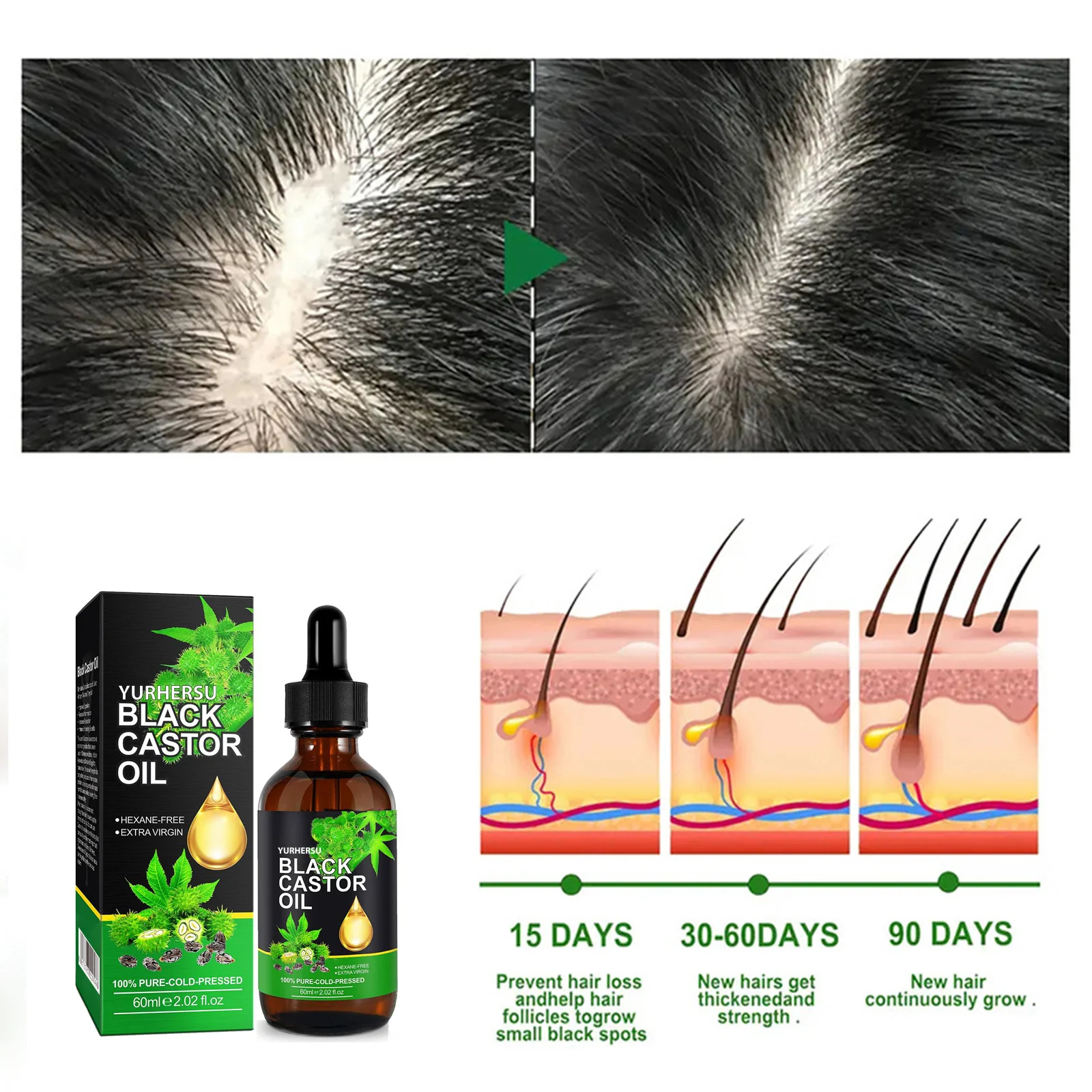 YURHERSU Black Castor Oil for Hair Growth & Skin Nail Care 6 black castor oil spu747947951276 desc 6