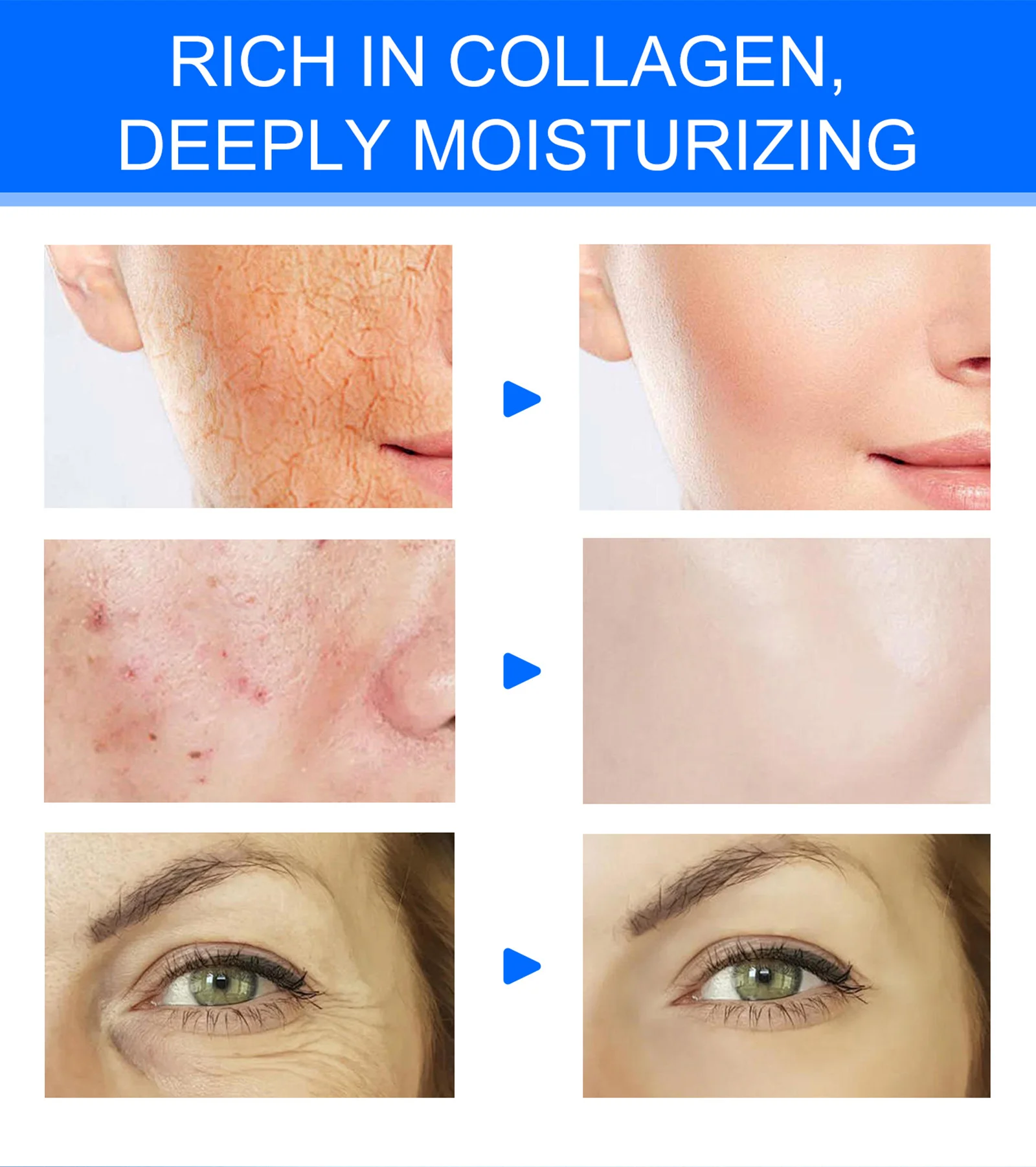 YURHERSU Collagen Cream with Retinol & Hyaluronic Acid for Firming & Hydration 5 collagen face cream spu957315549105 desc 5