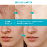 Dark Spot Corrector Serum Spu725908543053 2