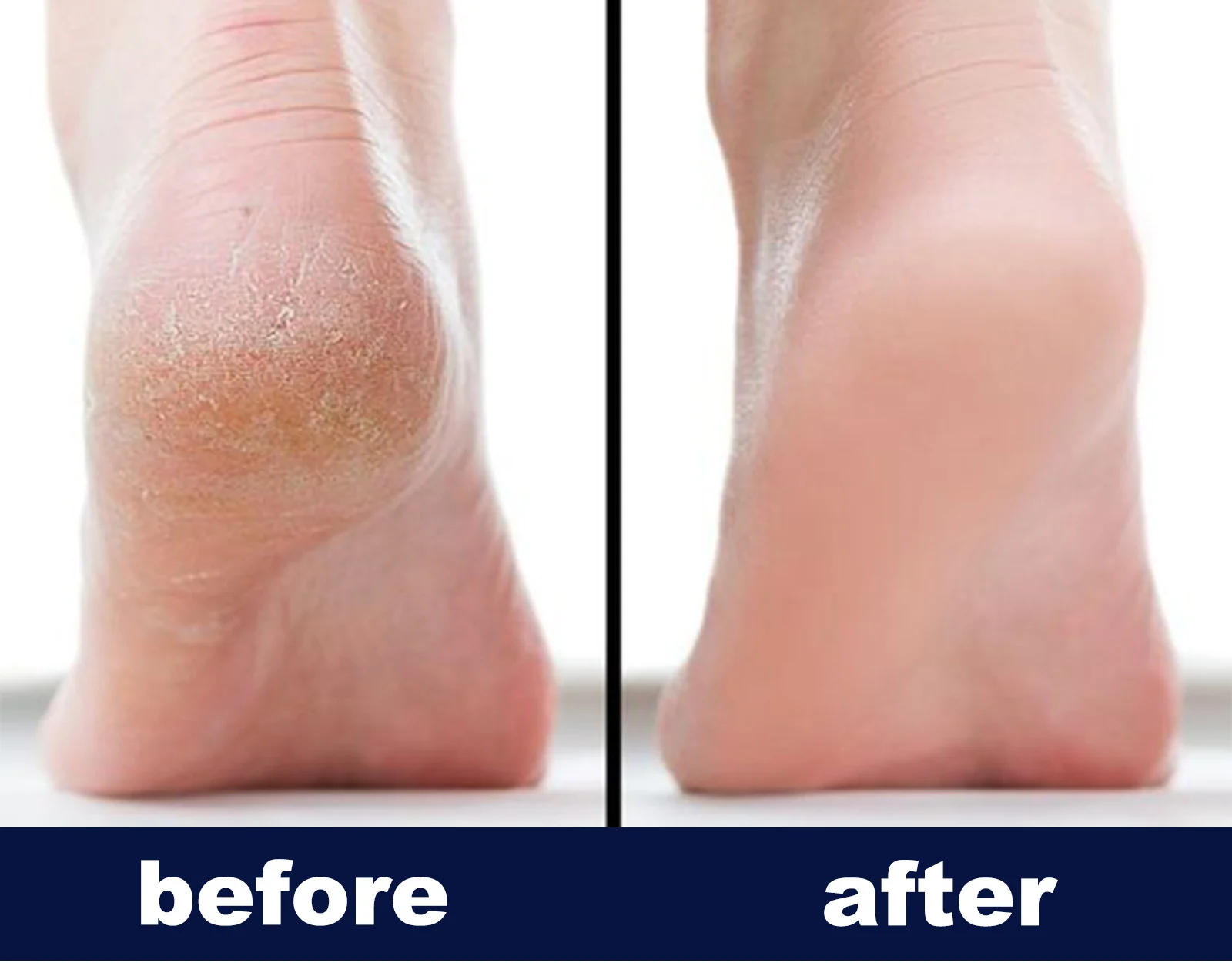 foot care cream spu997105340672 desc 7