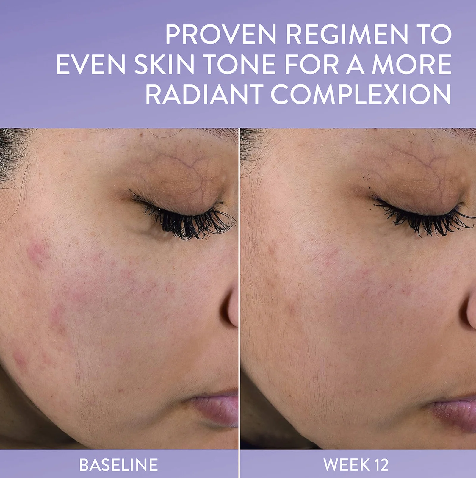 healing cream skin repair spu760557239654 desc 4