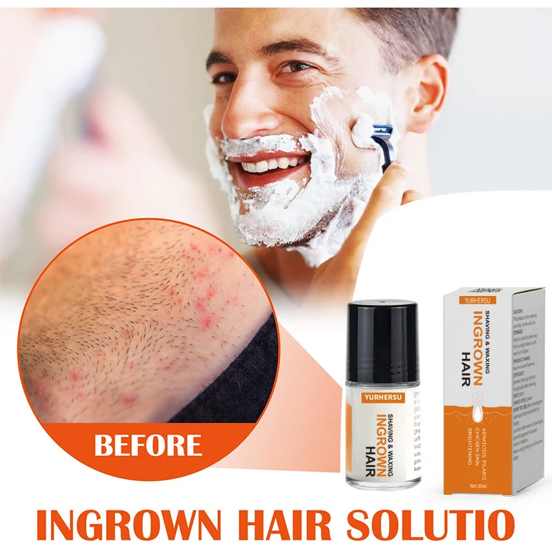 ingrown hair serum spu911139493461 desc 4