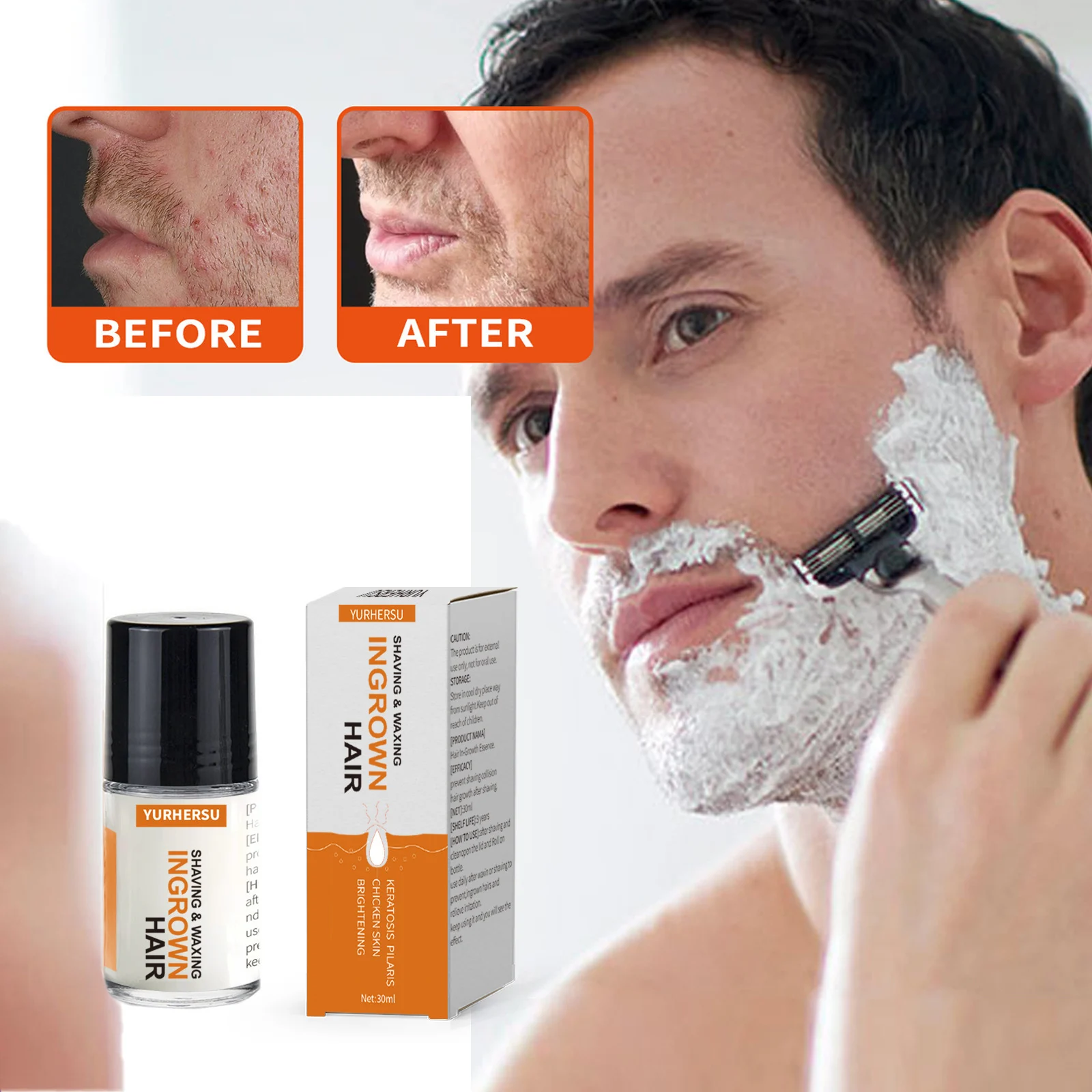 ingrown hair solution roll on spu904026312132 desc 2