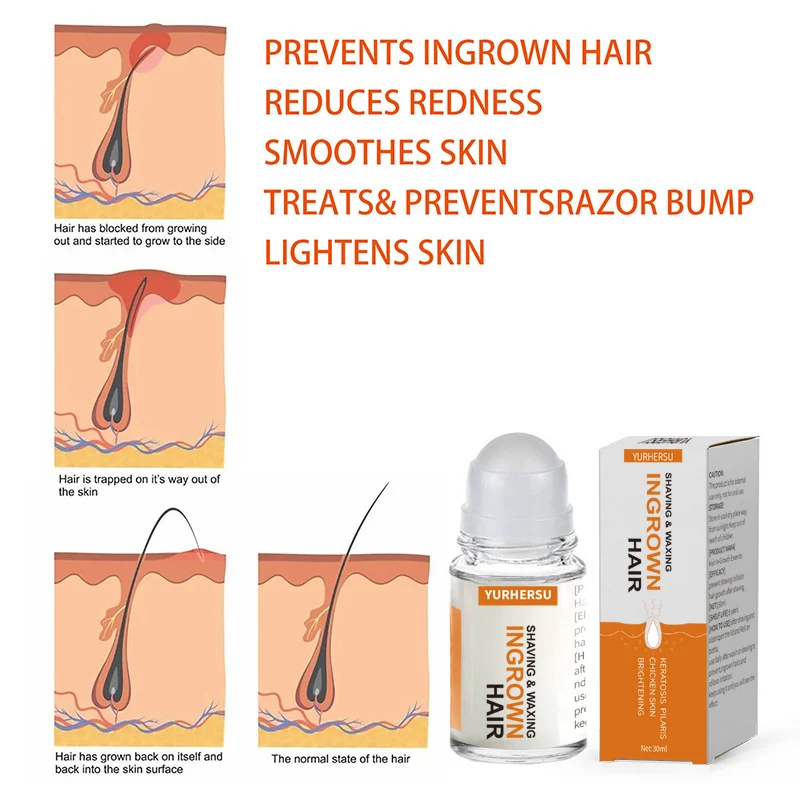 ingrown hair solution roll on spu904026312132 desc 5