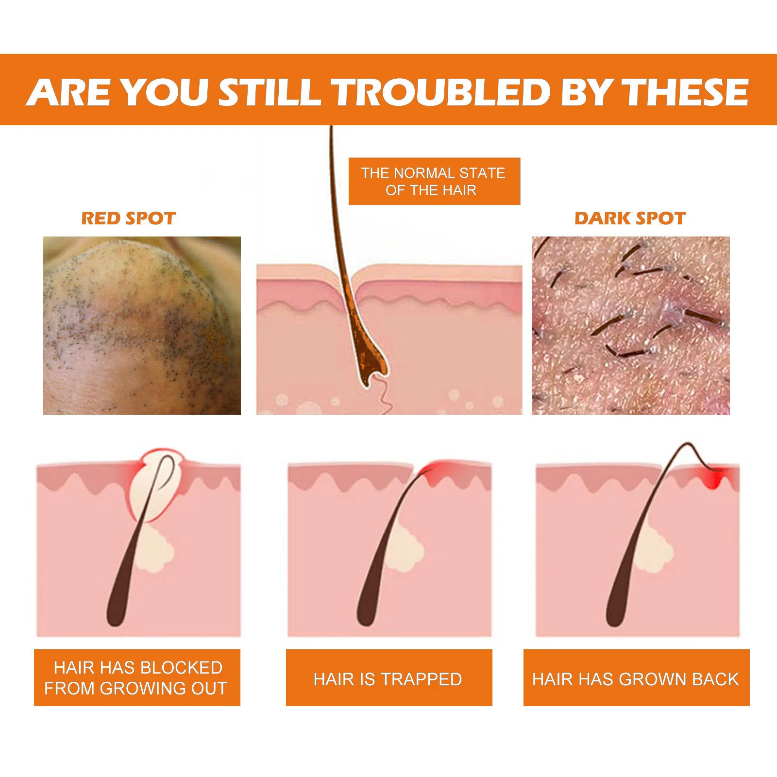 ingrown hair solution roll on spu904026312132 desc 6