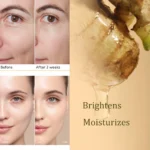 Kojic Acid Turmeric Niacinamide Serum Spu995045561884 4