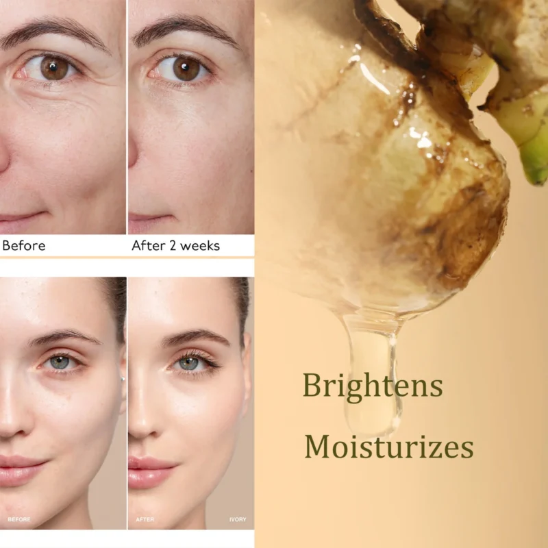 Kojic Acid Turmeric Niacinamide Serum Spu995045561884 4