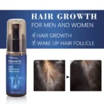 Minoxidil Hair Regrowth Treatment Spu812402332181 4