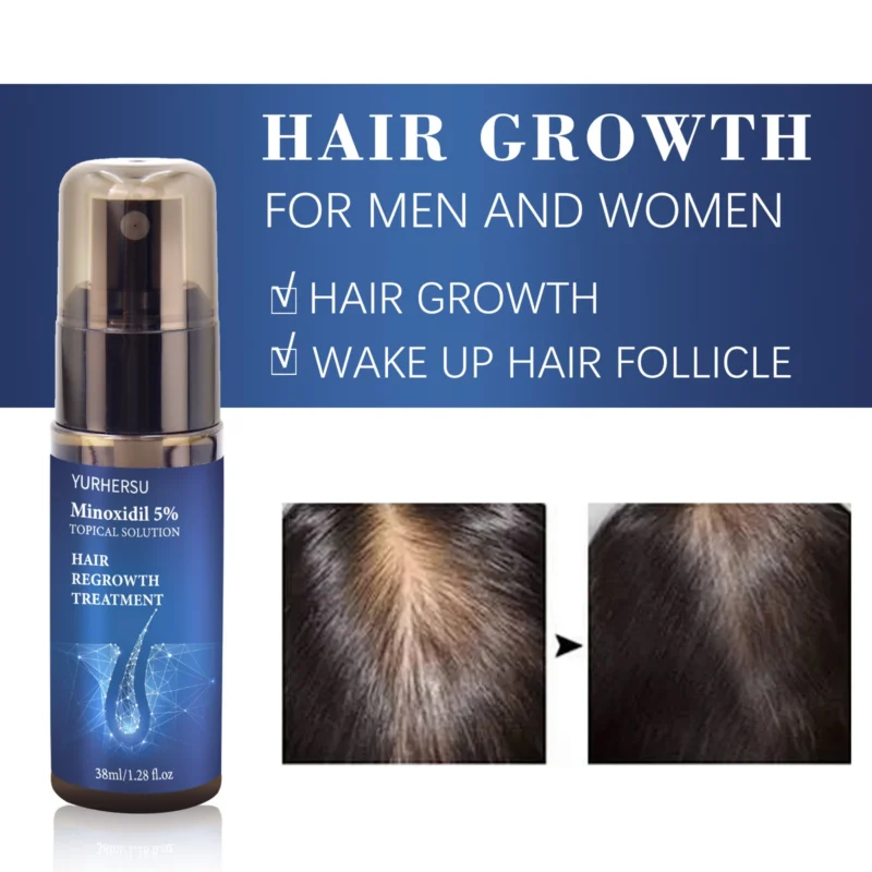 Minoxidil Hair Regrowth Treatment Spu812402332181 4