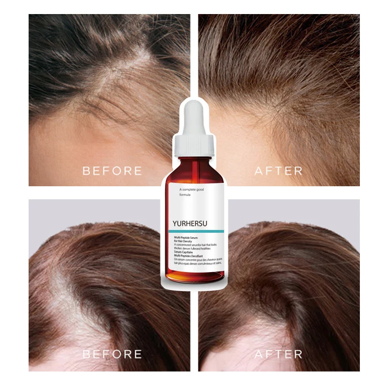 multi peptide hair serum spu973223124527 desc 9