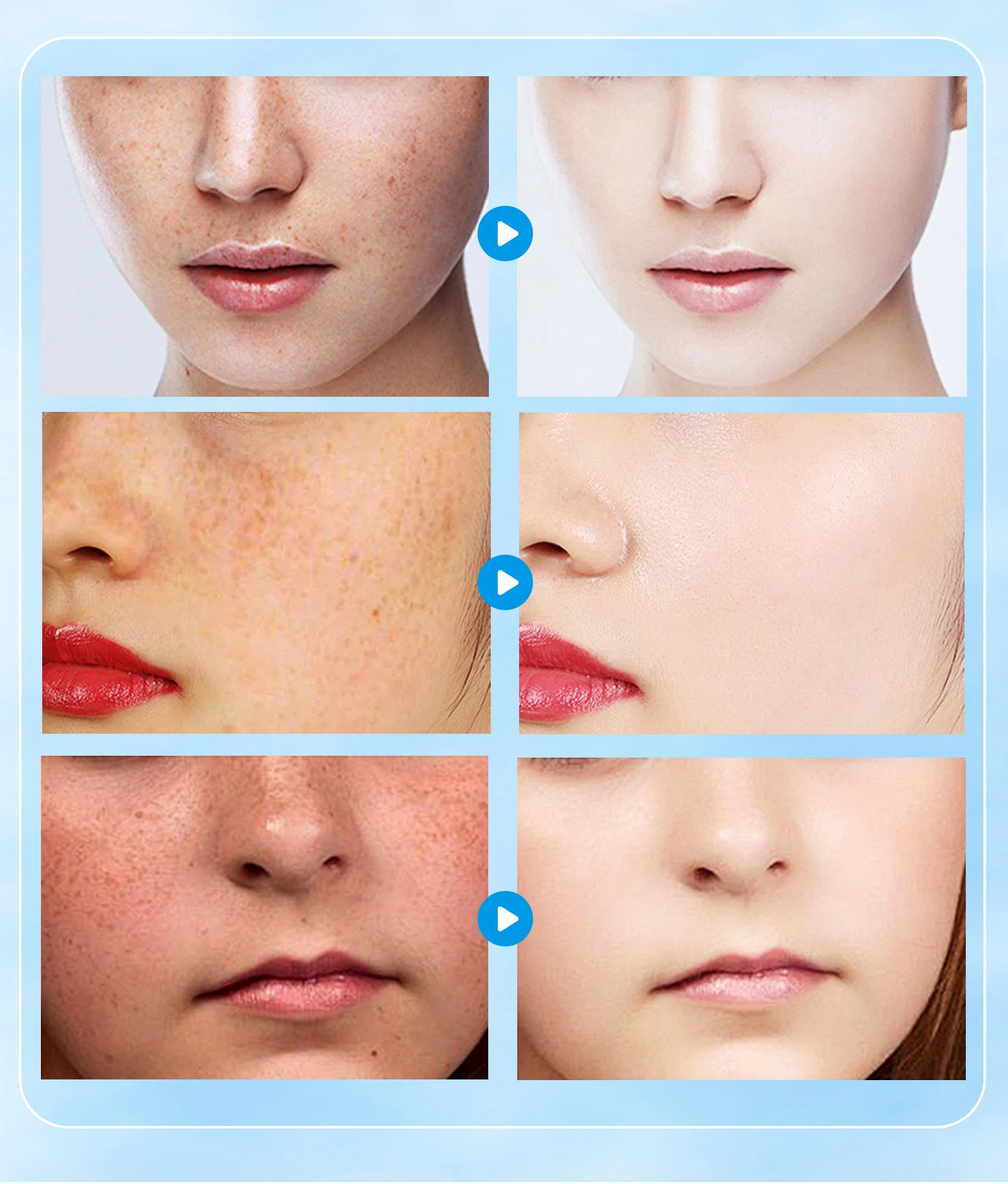 YURHERSU Niacinamide Care Cream - Brightening, Hydrating, Smoothing Face Cream 5 niacinamide care cream spu972320086240 desc 5