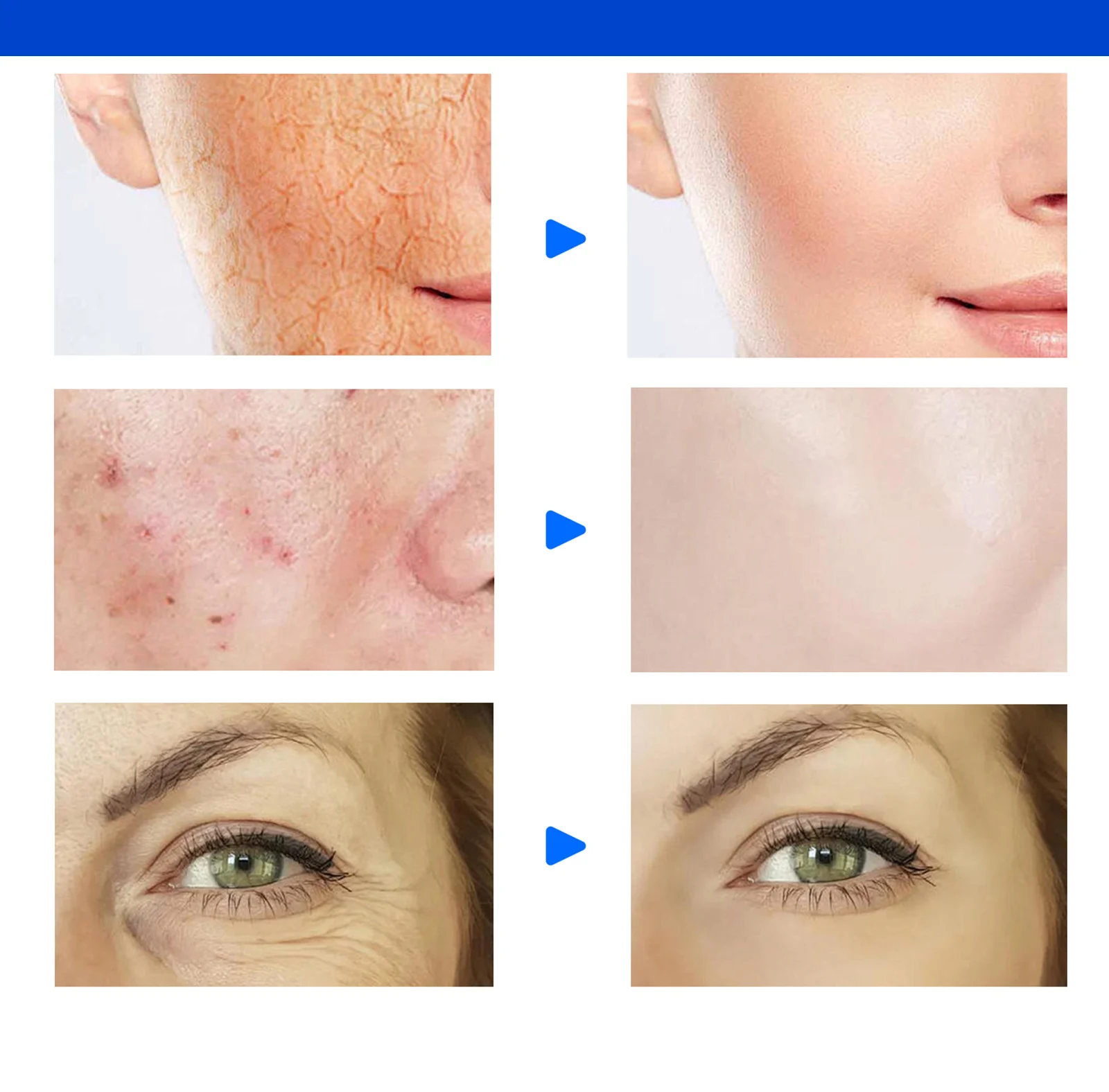 niacinamide moisturizing cream spu964366070793 desc 7