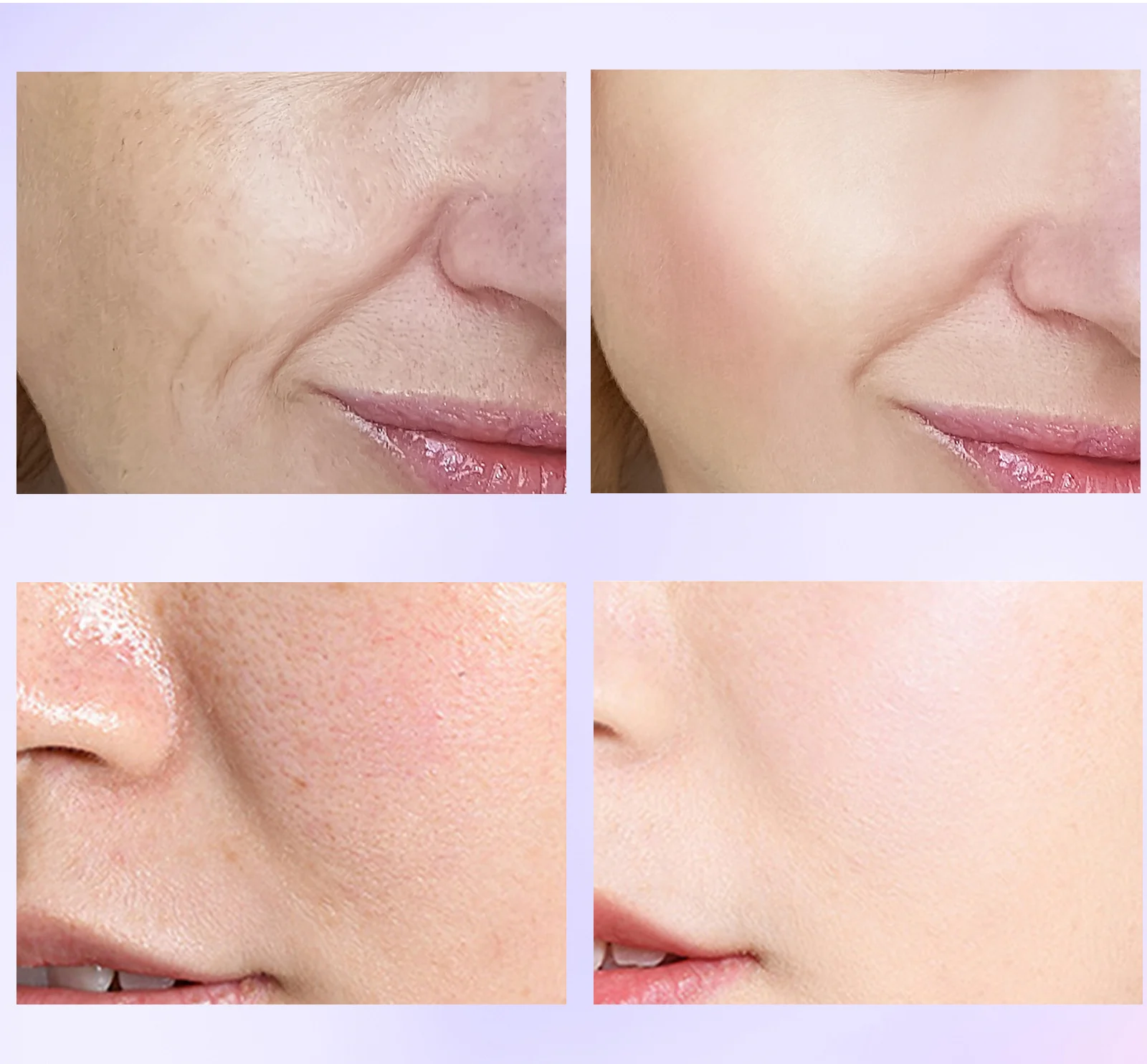 orchid essence oil serum spu862760723120 desc 6