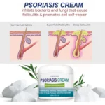 Psoriasis Cream Itch Relief Spu760493845062 3