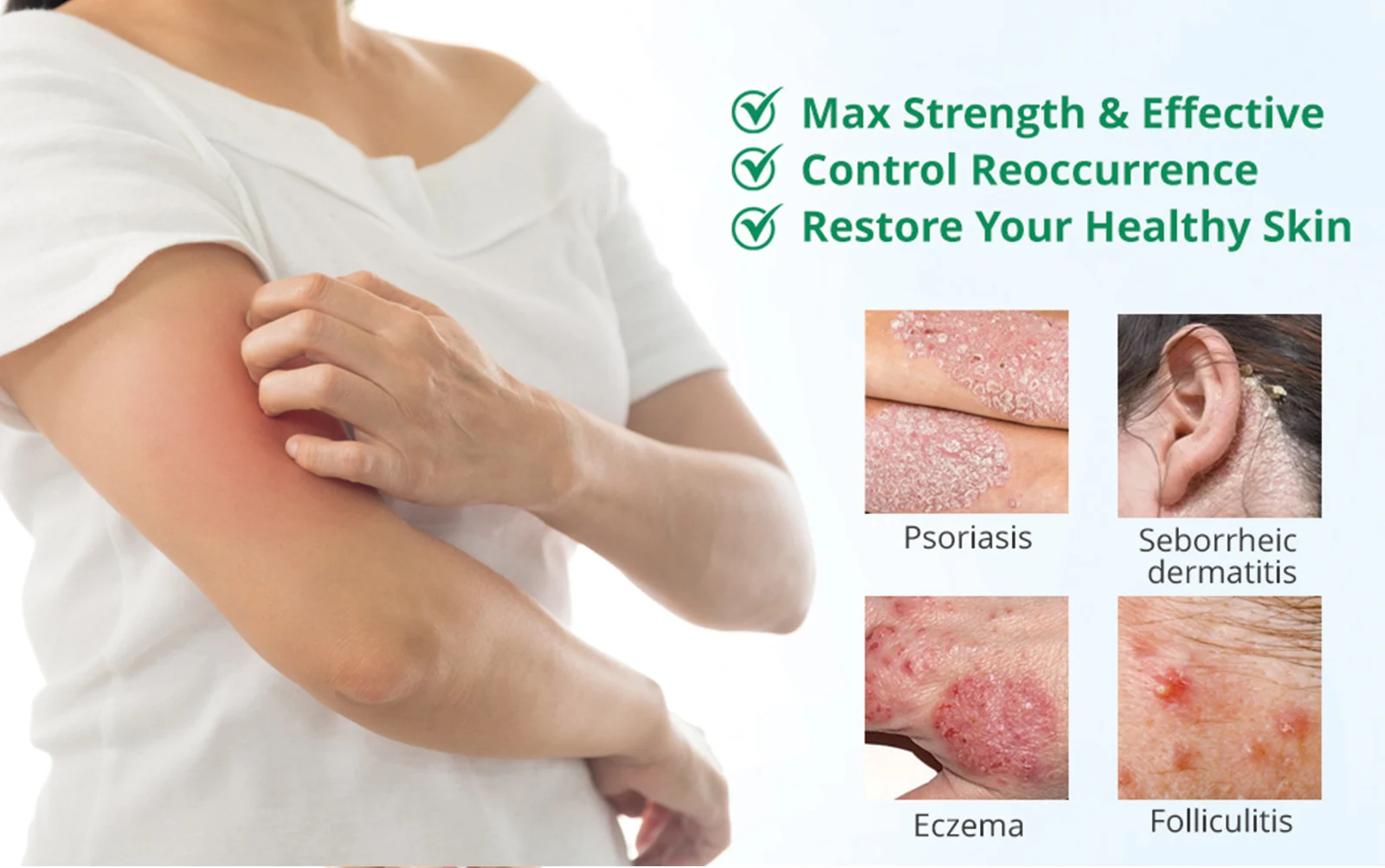 psoriasis cream itch relief spu760493845062 desc 6