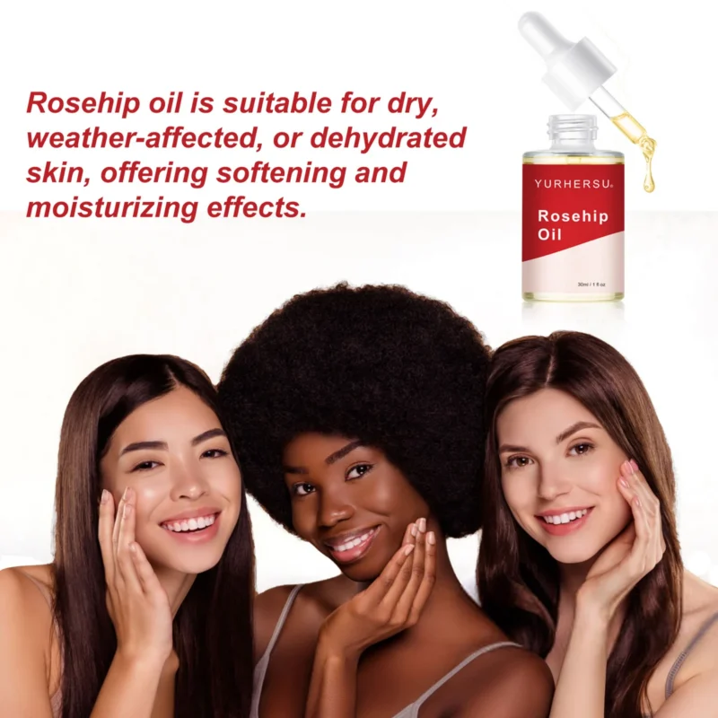 Rosehip Oil Face Body Spu862764243005 2