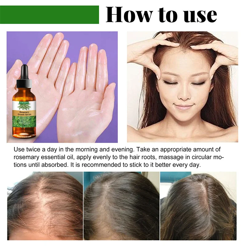 YURHERSU Rosemary Hair Growth Serum Oil - Stimulates Growth, Strengthens Hair, 30ml 10 rosemary hair growth serum oil spu723518999785 desc 10