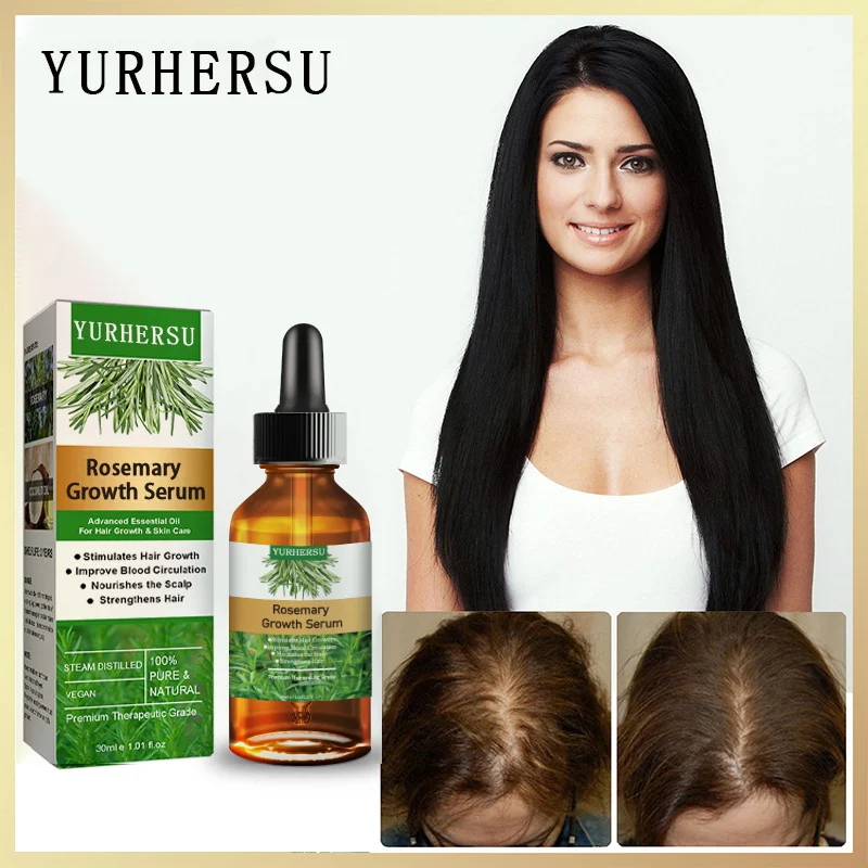 YURHERSU Rosemary Hair Growth Serum Oil - Stimulates Growth, Strengthens Hair, 30ml 3 rosemary hair growth serum oil spu723518999785 desc 3