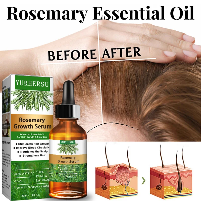 YURHERSU Rosemary Hair Growth Serum Oil - Stimulates Growth, Strengthens Hair, 30ml 5 rosemary hair growth serum oil spu723518999785 desc 5
