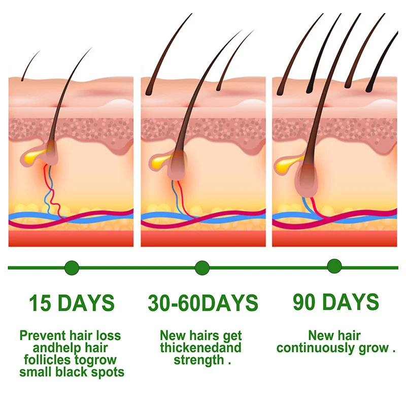 YURHERSU Rosemary Hair Growth Serum Oil - Stimulates Growth, Strengthens Hair, 30ml 6 rosemary hair growth serum oil spu723518999785 desc 6