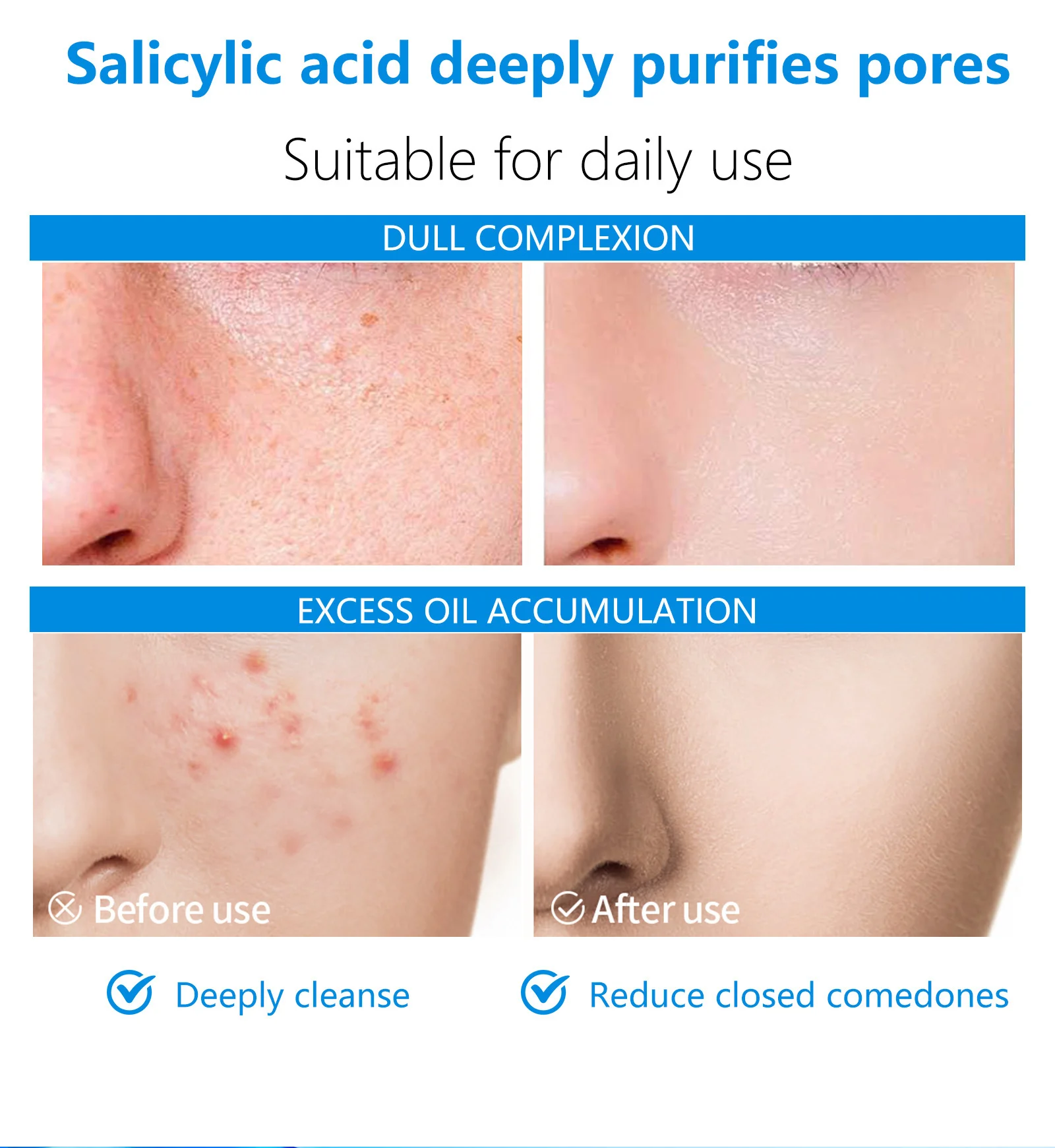salicylic acid cleansing pads spu1011775678525 desc 6