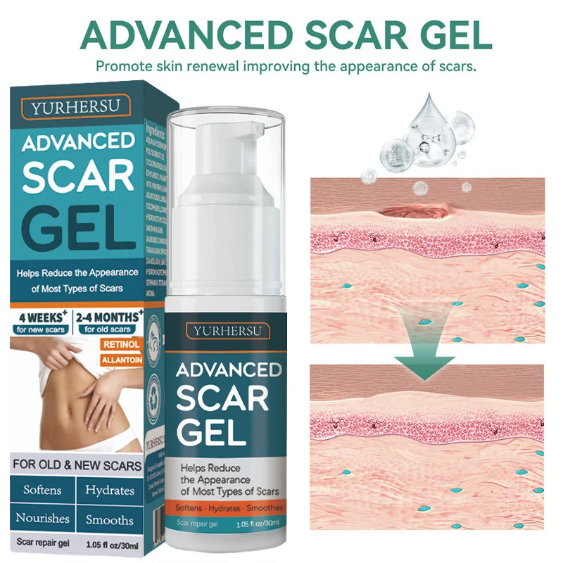 scar repair gel spu970457249834 desc 3