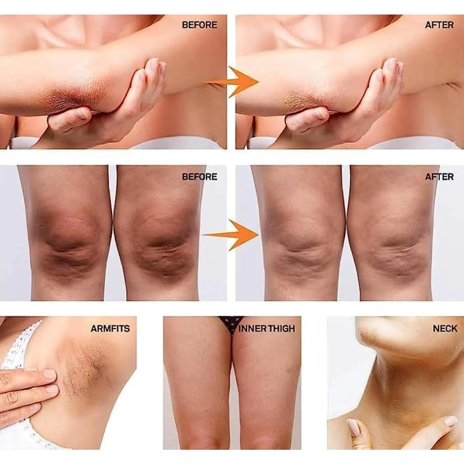 skin brightening cream whitening spu747790961630 desc 6