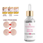 Skin Tag Remover Drops Spu742581404064 2
