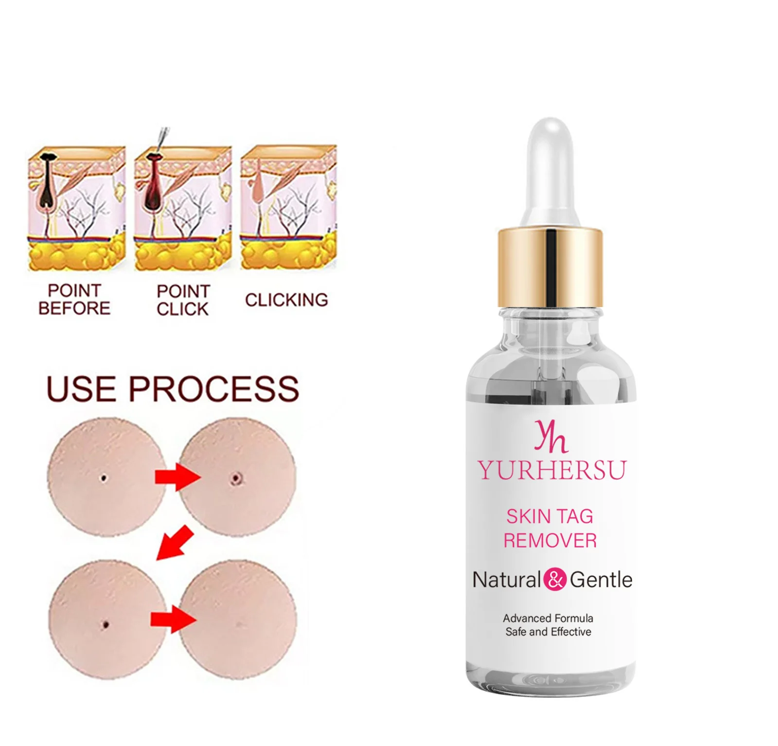 skin tag remover drops spu742581404064 desc 2