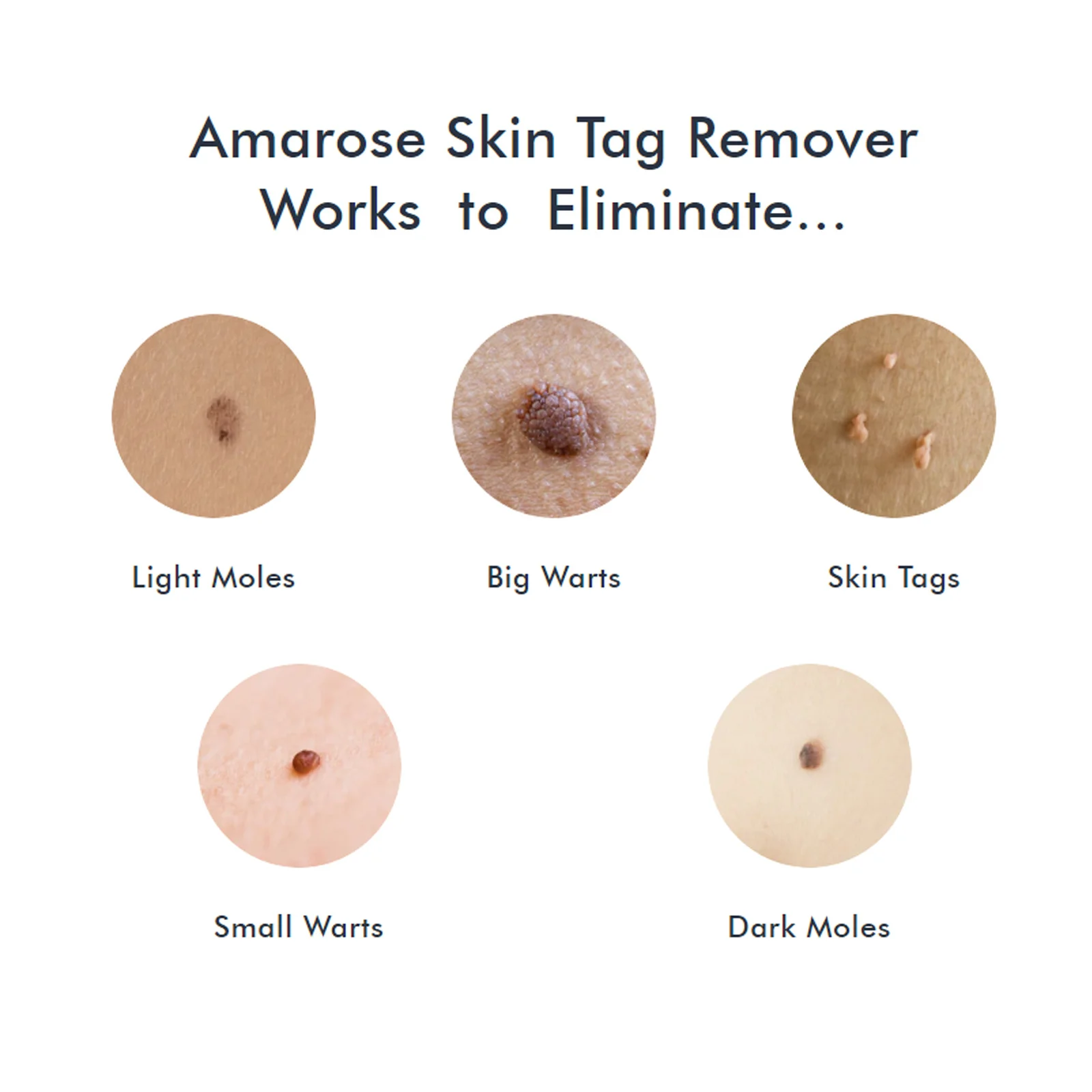 skin tag remover drops spu742581404064 desc 3