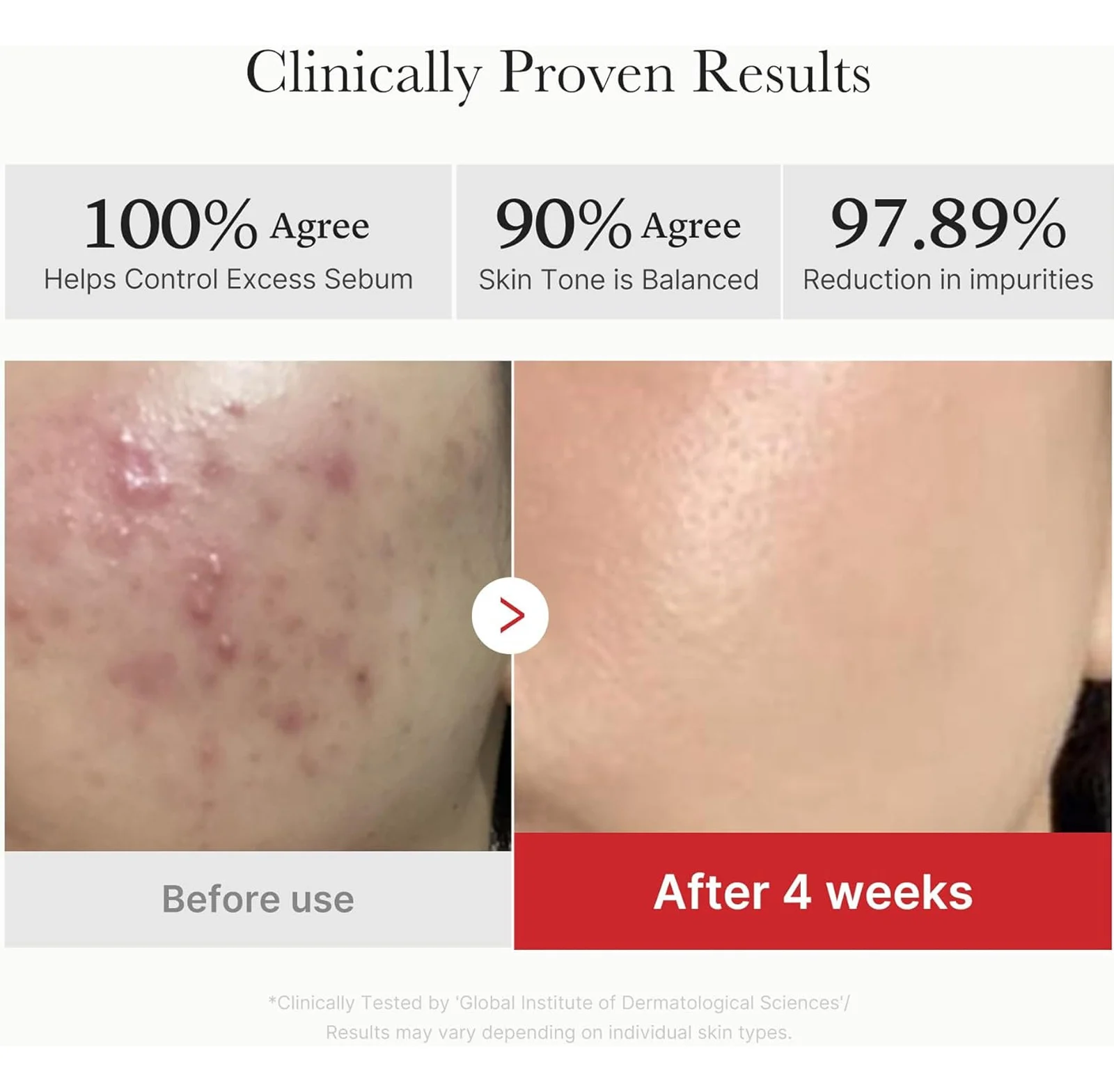 succinic acid exfoliating pads spu1003096835360 desc 9