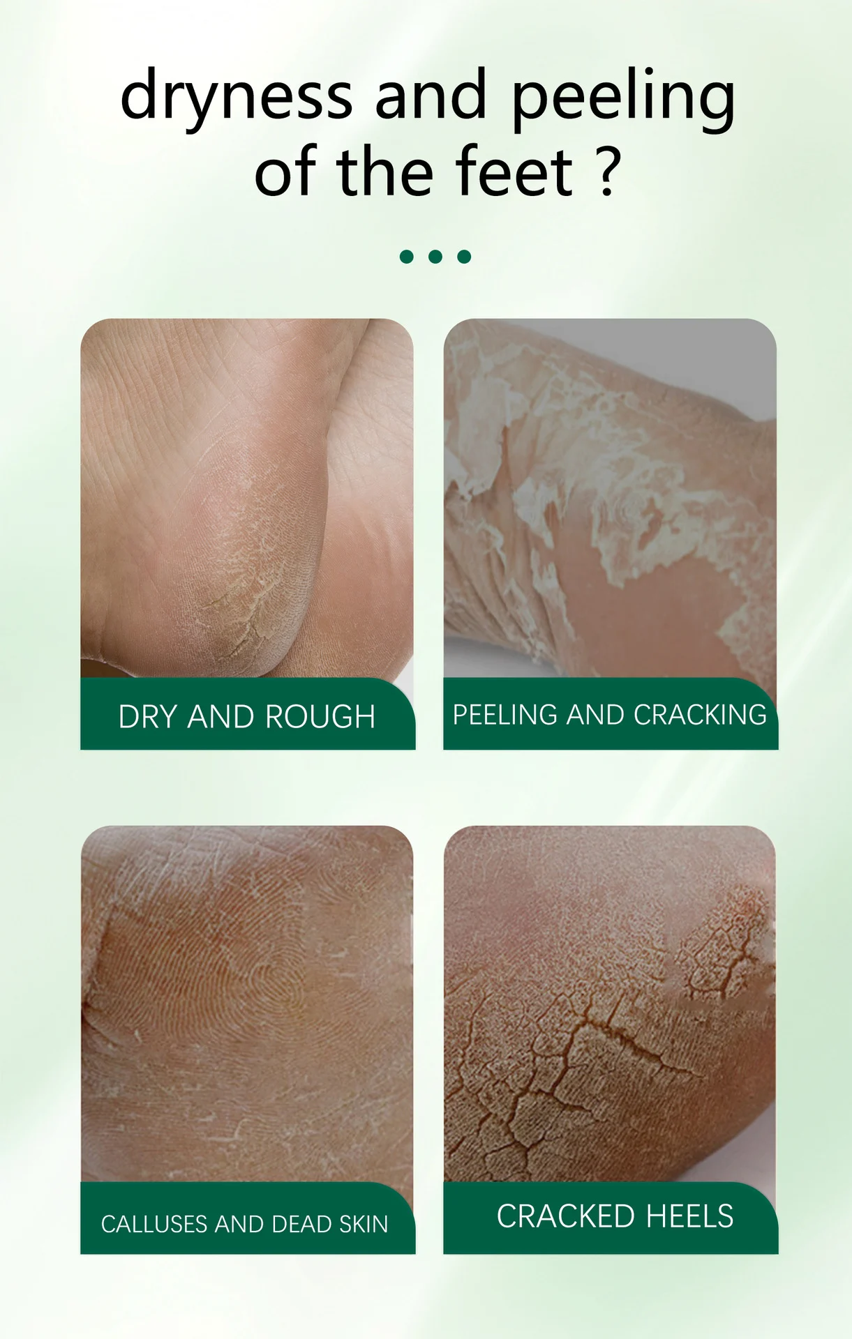 tea tree oil foot cream spu900592825248 desc 6