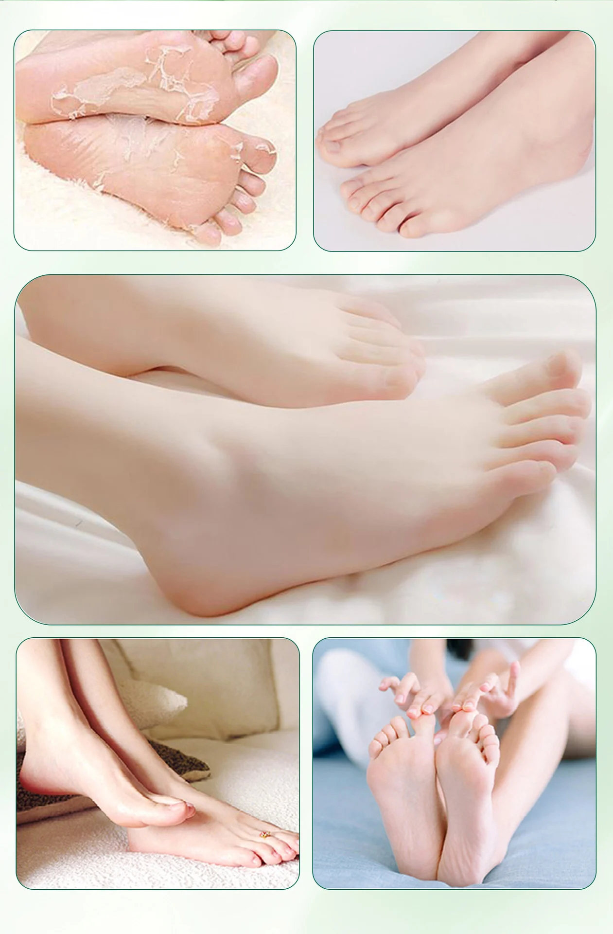 tea tree oil foot cream spu964203143591 desc 10