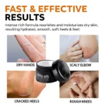 Urea Foot Body Cream Spu725581701579 2