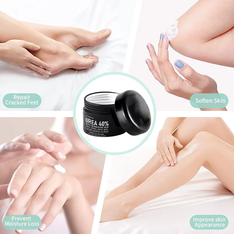 YURHERSU Urea 40% Foot & Body Cream with 2% Salicylic Acid for Dry Cracked Skin 13 urea foot body cream spu725581701579 desc 13