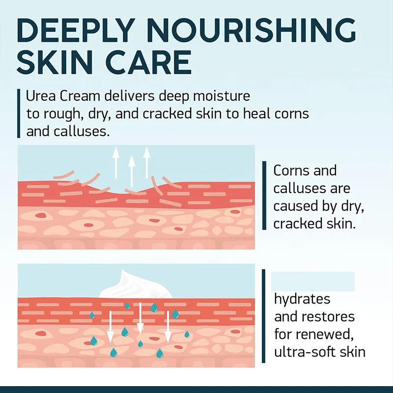 YURHERSU Urea 40% Foot & Body Cream with 2% Salicylic Acid for Dry Cracked Skin 7 urea foot body cream spu725581701579 desc 7