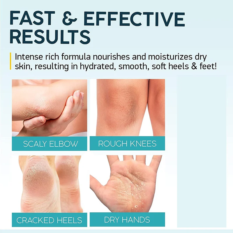 YURHERSU Urea 40% Foot & Body Cream with 2% Salicylic Acid for Dry Cracked Skin 8 urea foot body cream spu725581701579 desc 8