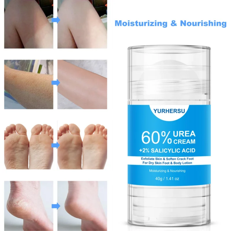 Urea Foot Body Cream Spu974042422938 3