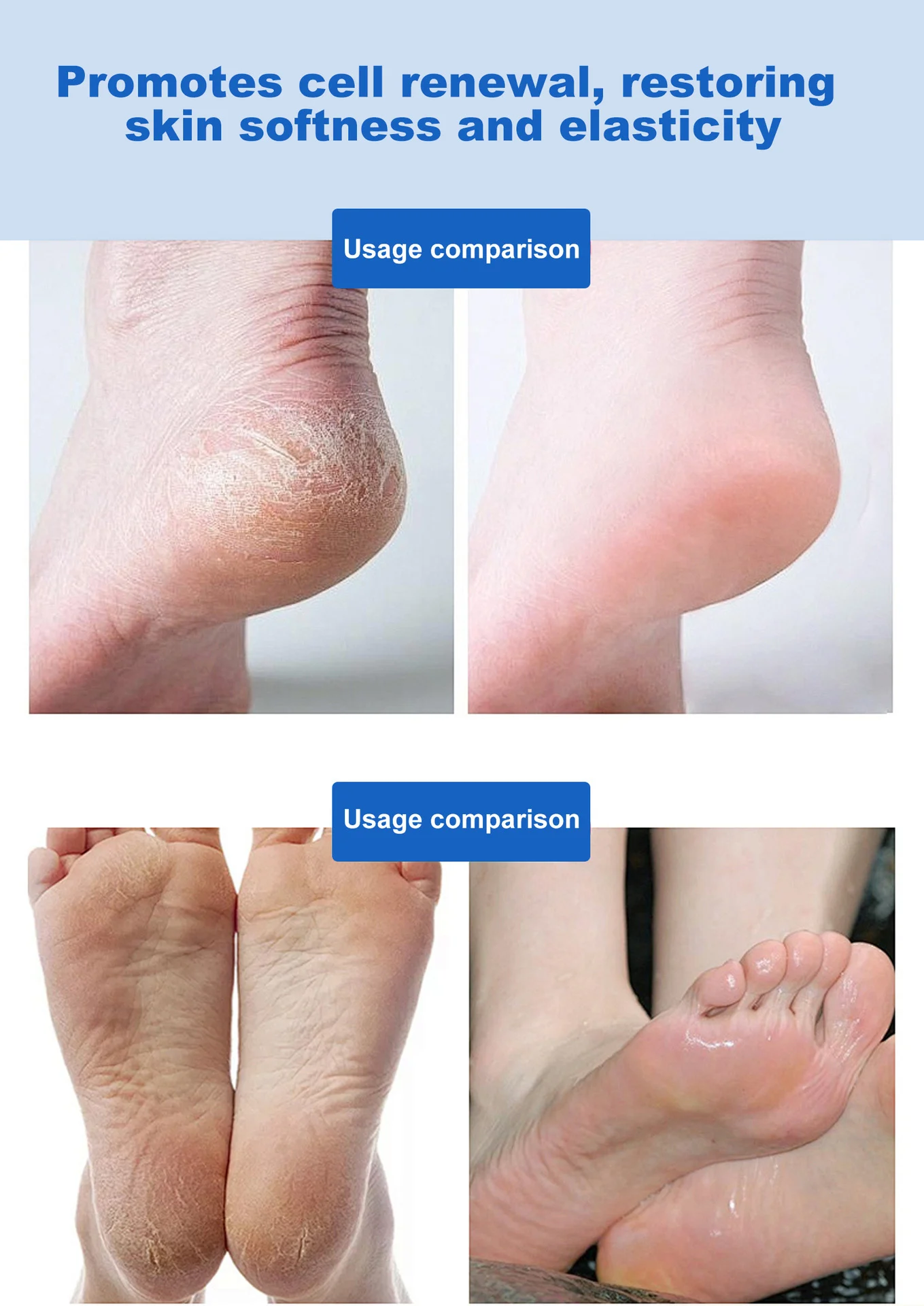 urea foot body cream spu974042422938 desc 6