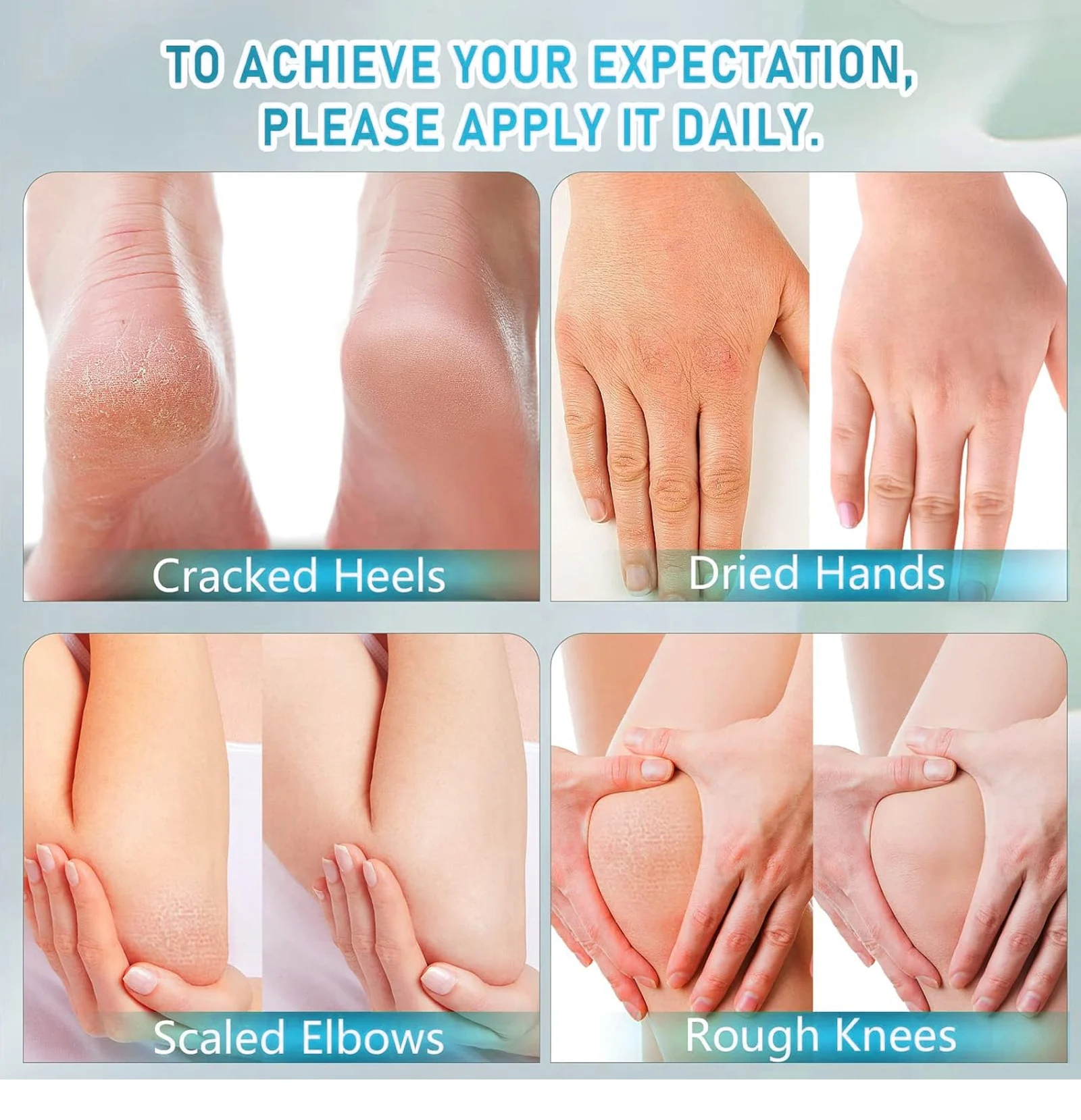 urea foot cream spu842160943669 desc 5